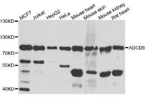 Western blot analysis of extracts of various cell lines, using ABCB8 antibody. (ABCB8 anticorps  (AA 469-718))
