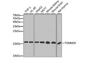 Western blot analysis of extracts of various cell lines, using TOMM20 antibody. (TOMM20 anticorps  (AA 20-145))