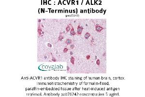 Image no. 2 for anti-Activin Receptor Type I (ACRV1) (N-Term) antibody (ABIN1731497)