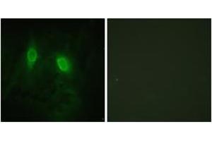 Immunofluorescence analysis of HeLa cells, using IKK-gamma (Ab-85) Antibody. (IKBKG anticorps  (AA 51-100))