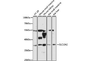 Western blot analysis of extracts of various cell lines, using SLC10 antibody (ABIN6130693, ABIN6147837, ABIN6147838 and ABIN6216622) at 1:3000 dilution. (SLC10A2 anticorps  (AA 289-348))