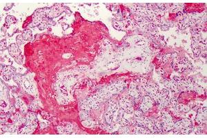 Human Placenta: Formalin-Fixed, Paraffin-Embedded (FFPE)