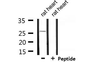 Western blot analysis of extracts from rat heart, using UBTD2 Antibody. (UBTD2 anticorps  (C-Term))
