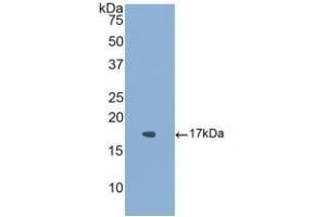 Detection of Recombinant ACVR1, Human using Polyclonal Antibody to Activin A Receptor Type I (ACVR1) (ACVR1 anticorps  (AA 208-340))