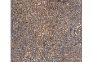 ABIN6267403 at 1/200 staining human lymph node tissue sections by IHC-P.