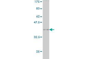 Western Blot detection against Immunogen (36. (MLLT10 anticorps  (AA 695-793))