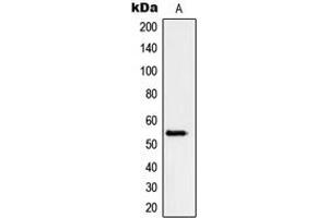 Western blot analysis of Peripherin expression in HeLa (A) whole cell lysates. (Peripherin anticorps  (C-Term))