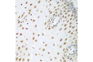 Immunohistochemistry of paraffin-embedded human esophagus using HDAC1 antibody. (HDAC1 anticorps  (AA 393-482))