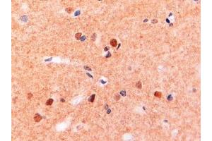 ABIN190775 (2µg/ml) staining of paraffin embedded Human Brain. (CD11b anticorps  (Internal Region))