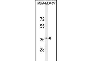 CADM1 Antibody (N-term) (ABIN654660 and ABIN2844356) western blot analysis in MDA-M cell line lysates (35 μg/lane). (CADM1 anticorps  (N-Term))