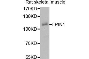 Western blot analysis of extracts of rat skeletal muscle cells, using LPIN1 antibody. (Lipin 1 anticorps)