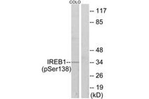 Western Blotting (WB) image for anti-Aconitase 1 (ACO1) (AA 106-155), (pSer138) antibody (ABIN1531675) (Aconitase 1 anticorps  (pSer138))