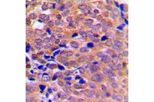 anti-AMPK1/AMPK2 (Center) antibody