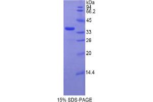 SDS-PAGE analysis of Rat TERT Protein. (TERT Protéine)