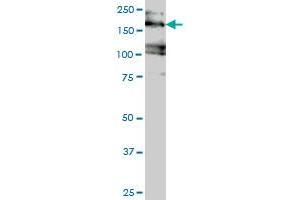EIF4G3 monoclonal antibody (M02), clone 1D7 Western Blot analysis of EIF4G3 expression in Jurkat . (EIF4G3 anticorps  (AA 1-515))
