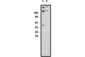 Image no. 1 for anti-Zinc Finger Protein GLI1 (GLI1) antibody (ABIN793724) (GLI1 anticorps)