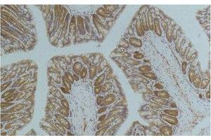 Immunohistochemistry of paraffin-embedded Mouse colon tissue using AMPK alpha1 Monoclonal Antibody at dilution of 1:200. (PRKAA1 anticorps)