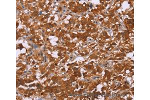 Immunohistochemistry of Human brain  using DCBLD2 Polyclonal Antibody at dilution of 1:50 (DCBLD2 anticorps)