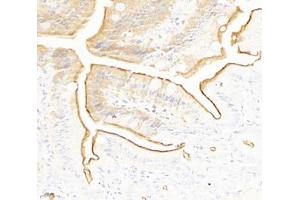 Immunohistochemistry analysis of paraffin-embedded mouse small intestine using PLS1 (ABIN7075096) at dilution of 1: 2000