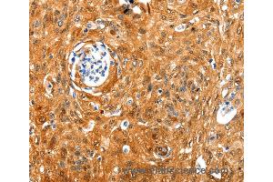 Immunohistochemistry of Human tonsil using NCOR1 Polyclonal Antibody at dilution of 1:100 (NCOR1 anticorps)