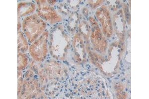 Used in DAB staining on fromalin fixed paraffin- embedded Kidney tissue