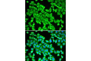 Immunofluorescence analysis of HeLa cells using STIP1 antibody (ABIN6133089, ABIN6148592, ABIN6148593 and ABIN6218351). (STIP1 anticorps  (AA 1-300))