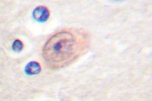 Image no. 1 for anti-CSE1 Chromosome Segregation 1-Like (CSE1L) antibody (ABIN265374) (Exportin 2 anticorps)