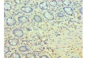 Immunohistochemistry of paraffin-embedded human small intestine tissue using ABIN7162803 at dilution of 1:100