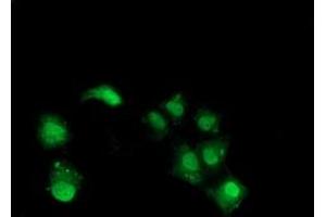 Anti-NHEJ1 mouse monoclonal antibody (ABIN2454029) immunofluorescent staining of COS7 cells transiently transfected by pCMV6-ENTRY NHEJ1 (RC203393). (NHEJ1 anticorps)