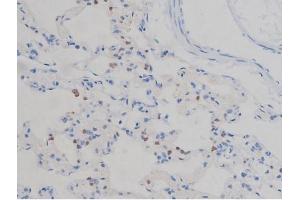 ABIN6267335 at 1/200 staining Rat lung tissue sections by IHC-P. (IGF1R anticorps  (pTyr1165, pTyr1166))