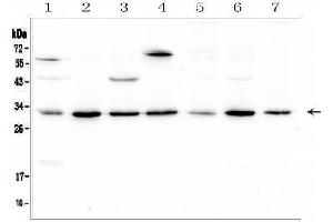 Western blot analysis of RPS3 using anti-RPS3 antibody (ABIN6719371).