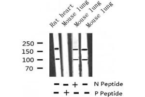 Western blot analysis of Phospho-IGF1R (Tyr1346) expression in various lysates (IGF1R anticorps  (pTyr1346))