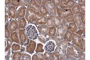 IHC-P Image VEGF antibody detects VEGF protein at cytoplasm in mouse kidney by immunohistochemical analysis. (VEGFA anticorps  (C-Term))