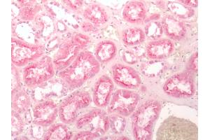 Human Kidney: Formalin-Fixed, Paraffin-Embedded (FFPE)