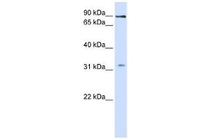LRRC8B antibody used at 1 ug/ml to detect target protein.