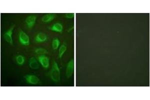Immunofluorescence analysis of HeLa cells, using Calnexin (Ab-583) Antibody. (Calnexin anticorps  (AA 543-592))