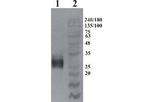 Western Blotting (WB) image for anti-GDNF Family Receptor alpha 4 (GFRA4) antibody (ABIN1450233) (GFRA4 anticorps)