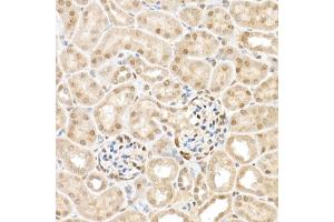 Immunohistochemistry of paraffin-embedded mouse kidney using TAZ Rabbit pAb (ABIN6130800, ABIN6150278, ABIN6150279 and ABIN6224227) at dilution of 1:50 (40x lens).