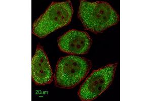 Immunofluorescent analysis of A549 cells, using ALOX12 Antibody (C-term) (ABIN652825 and ABIN2842537).