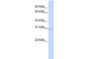 WB Suggested Anti-HOXA9 Antibody Titration:  0. (HOXA9 anticorps  (Middle Region))