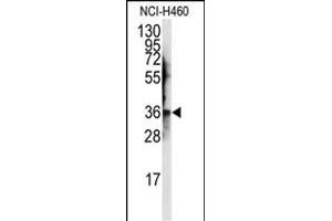 Western blot analysis of anti-JTV1 Antibody (Center) (ABIN389383 and ABIN2839480) in NCI- cell line lysates (35 μg/lane). (AIMP2 anticorps  (AA 156-184))