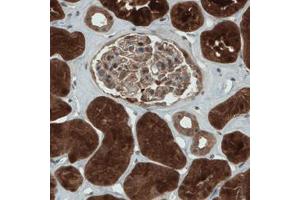 Immunohistochemical staining (Formalin-fixed paraffin-embedded sections) of human kidney with NAPRT1 monoclonal antibody, clone CL0366  shows strong cytoplasmic immunoreactivity in renal tubules. (NAPRT1 anticorps)