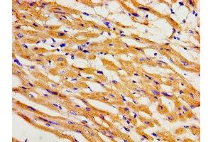 Immunohistochemistry of paraffin-embedded human heart tissue using ABIN7163993 at dilution of 1:100