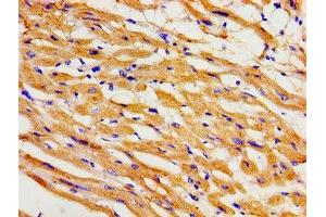 Immunohistochemistry of paraffin-embedded human heart tissue using ABIN7163993 at dilution of 1:100 (KCNH2 anticorps  (AA 894-1137))