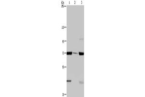 Gel: 6 % SDS-PAGE, Lysate: 40 μg, Lane 1-3: LoVo cells, human testis tissue, A549 cells, Primary antibody: ABIN7129423(FAAH Antibody) at dilution 1/400, Secondary antibody: Goat anti rabbit IgG at 1/8000 dilution, Exposure time: 2 minutes (FAAH anticorps)