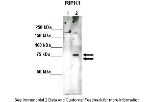 Lanes:   Lane 1: 10ug 293(Trex)FlpIn-RIPK1-HA-Strep (-Doxycycline)-non induced Lane 2: 10ug 293(Trex)FlpIn-RIPK1-HA-Strep (+Doxycycline)-induced  Primary Antibody Dilution:    1:1000  Secondary Antibody:   Anti-rabbit HRP  Secondary Antibody Dilution:    1:2000  Gene Name:   RIPK1  Submitted by:   Dr. (RIPK1 anticorps  (Middle Region))