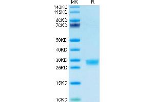 IL-2 Protein (AA 21-169) (His-Avi Tag)