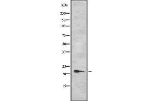 Western blot analysis of TPD52L1 using LOVO whole cell lysates (TPD52L1 anticorps  (N-Term))