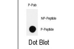 Dot Blot (DB) image for anti-Homeodomain Interacting Protein Kinase 2 (HIPK2) (pTyr361) antibody (ABIN3001890) (HIPK2 anticorps  (pTyr361))