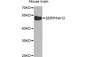 Western blot analysis of extracts of mouse brain, using SERPINA12 Antibody. (SERPINA12 anticorps)